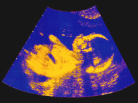 ������� � ������ ������. ����������